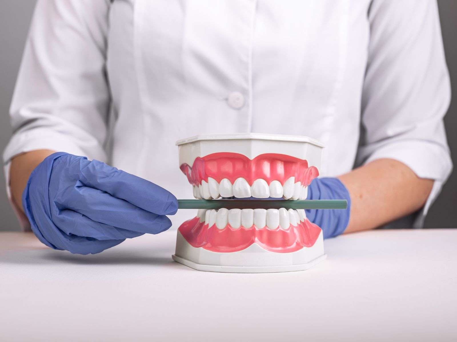malocclusione dentale